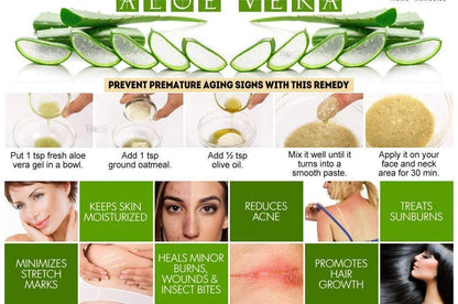 Online Quality Store Organic Aloe Vera Gel, 200g