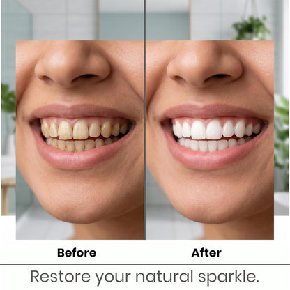 REORIC Activated Charcoal Powder for Teeth Cleaning & Oral Care -50g